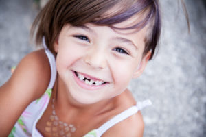 Little girl with big smile and missing milk teeth